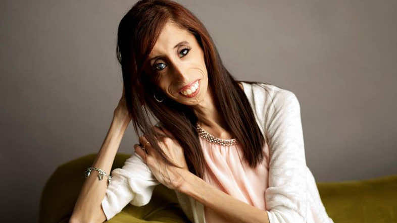  World s Ugliest Woman Now Inspires People All Over The Globe With Her true Beauty 