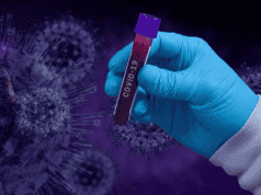 Morocco Records 339 New COVID-19 Cases