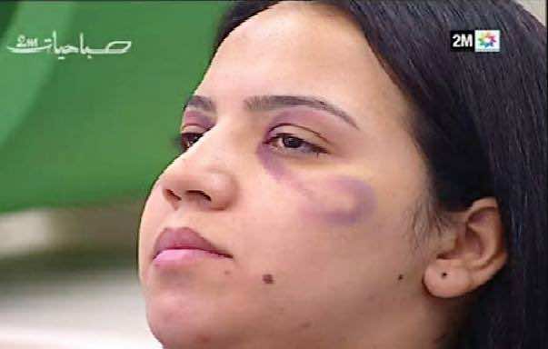 2M Broadcasts Women’s Makeup Tutorial on How to Hide Traces of Domestic Violence 