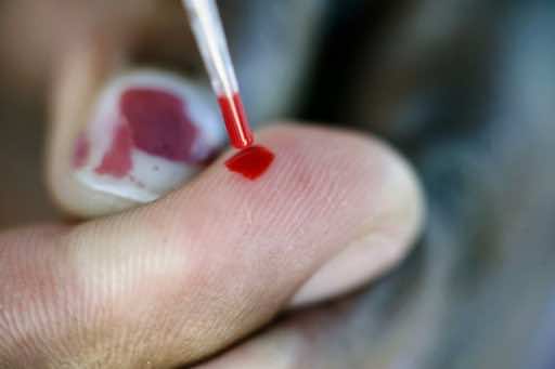 Daily-dose HIV prevention fails for African women: study