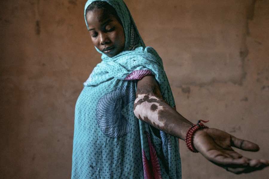 Through the Lens:  Moroccan Photographer Captures Injustice