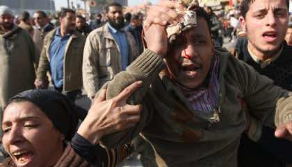 Egypt detains US citizen, 38 others for torching tram