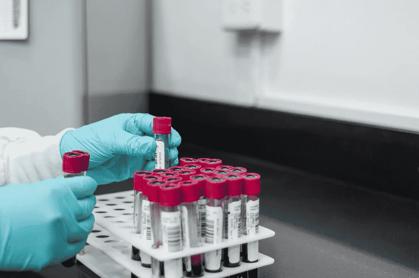 Morocco Confirms 5,415 New COVID-19 Cases, 82 Deaths in 24 Hours