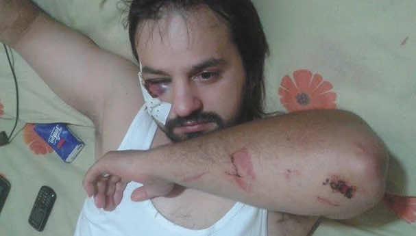 Fez: Man Violently Beaten and Robbed