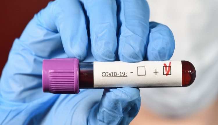 Morocco Confirms 111 New COVID-19 Cases, 469 Recoveries, 1 Death