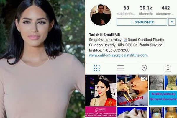 Plastic Surgeon Congratulates Sara Belkziz on Winning Miss Morocco