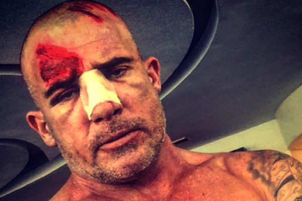 Prison Break Star Shocked by Poor Health Facilities in Ouarzazate