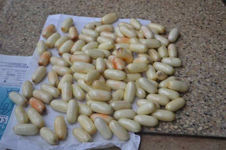Moroccan Police Arrest Brazilian Smuggling 610 grams of Cocaine inside Stomach