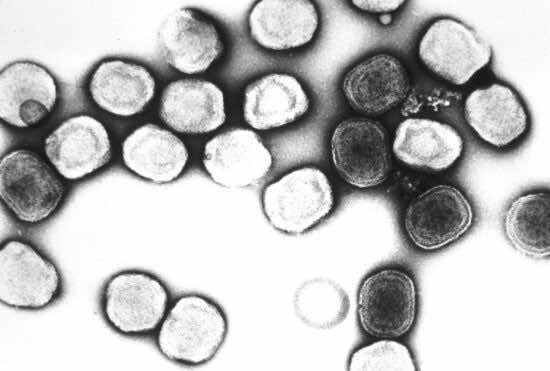 Minister: Monkeypox Situation in Morocco Is ‘Under Control’