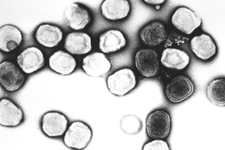 Monkeypox: Seven Suspected Cases Tested Negative in Morocco