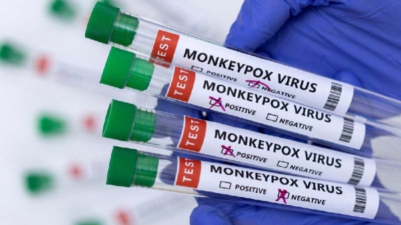 Morocco Achieves Milestone with Locally-Made PCR Test for Mpox