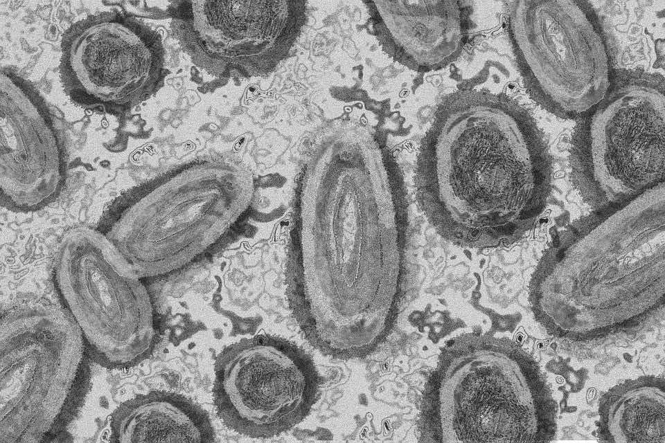 Morocco Reports First Monkeypox Case