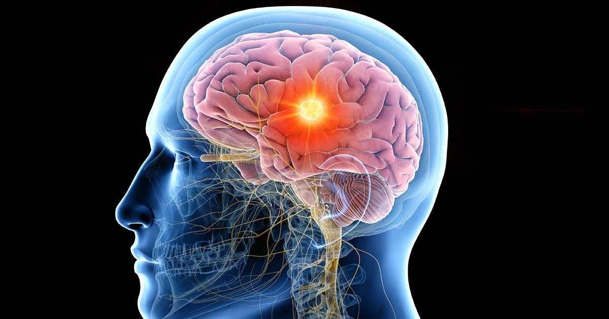 Over 400,000 People Suffer From Epilepsy in Morocco