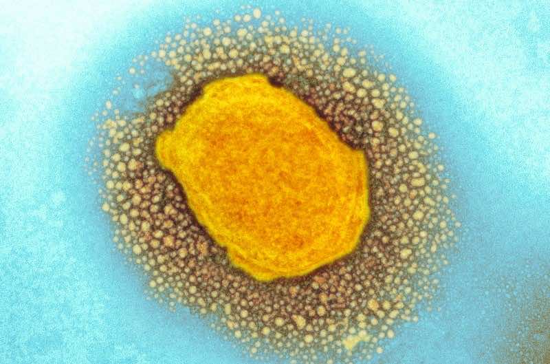 Spain, Brazil Report First Monkeypox Deaths Outside Africa