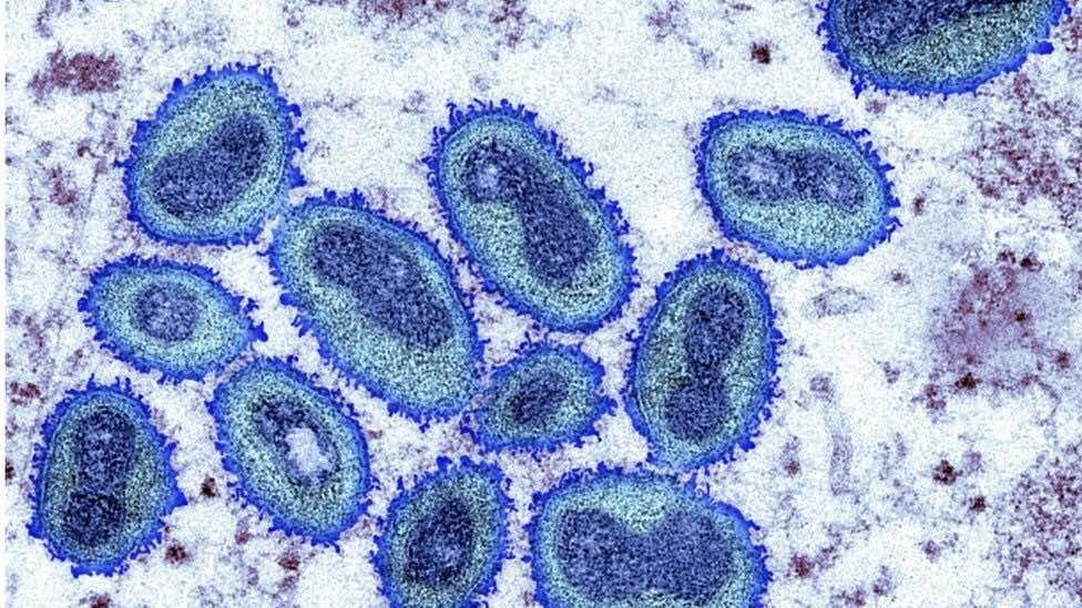 WHO Declares Monkeypox Outbreak a Global Health Emergency