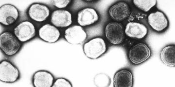 measles outbreak in Moroccan prisons.