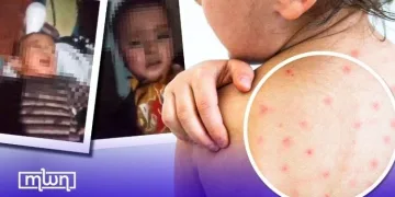 French health authorities are urging vigilance and precaution after having registered several cases of measles imported from Morocco since the start of the year.