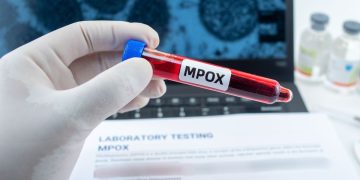 Morocco pioneers African-made mpox tests amid continental disease outbreak.