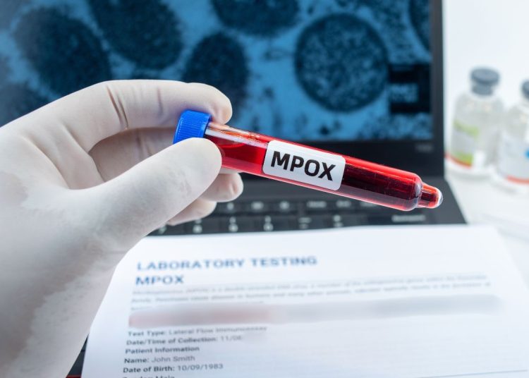 Morocco pioneers African-made mpox tests amid continental disease outbreak.