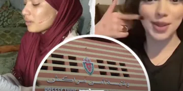 Marrakech Police Investigate Teen for Cyberbullying Influencer Selma After Blade Attack