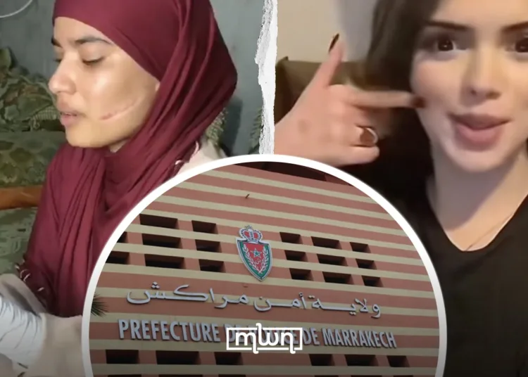 Marrakech Police Investigate Teen for Cyberbullying Influencer Selma After Blade Attack