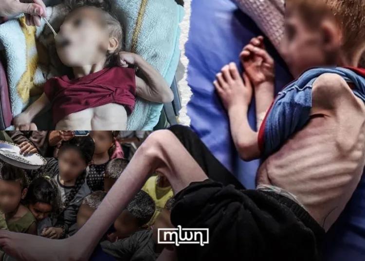 Gaza Genocide: Starvation Death Toll Rises, Israeli Strikes Kill More Civilians