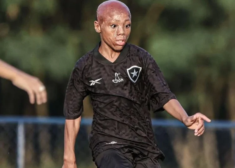 Bernardo Lopez: From Near Death to Botafogo’s Youth Academy