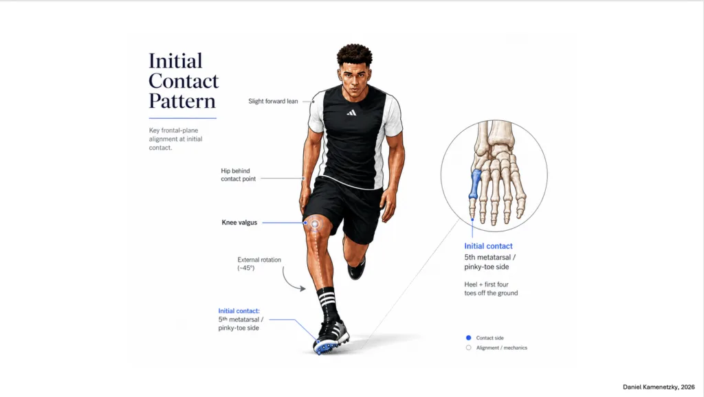 Figure 1 — Sprinting sequence and load pathway. Lateral foot contact, external rotation, and knee drift may increase rotational and eccentric loading across the ankle–knee–hip–posterior-chain system.