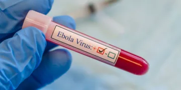 The World Health Organization (WHO) on Sunday declared the Ebola outbreak in the Democratic Republic of Congo and Uganda a public health emergency of international concern.