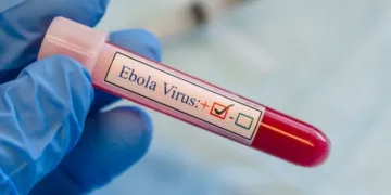 Ebola virus.