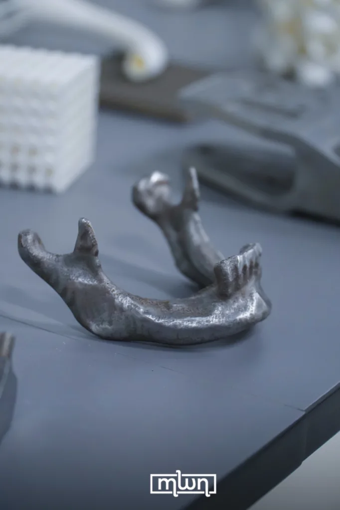 3D Printed Metal Jaw at UEMF / MWN Photography Team