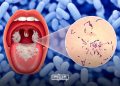 Morocco Reports Two Family Clusters of Diphtheria in Souss-Massa