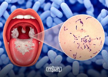 Morocco Reports Two Family Clusters of Diphtheria in Souss-Massa