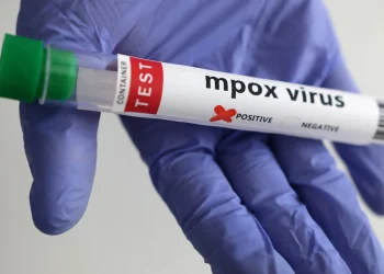 Illustration of a laboratory test for mpox, showing a positive result.