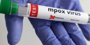Illustration of a laboratory test for mpox, showing a positive result.